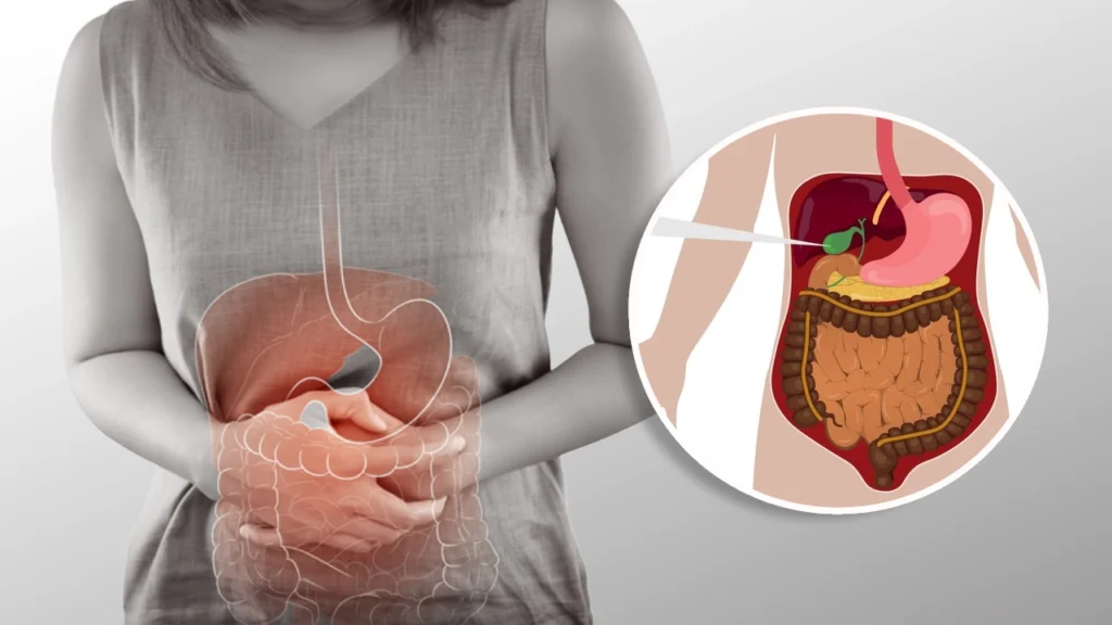 Stomach ulcer, appetite loss and constipation treatment
