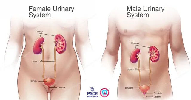 Kidney stone and hydrocele treatment
